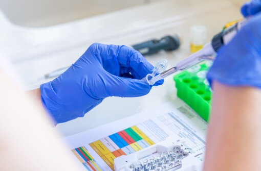 Assay Development Services Assay Development Services