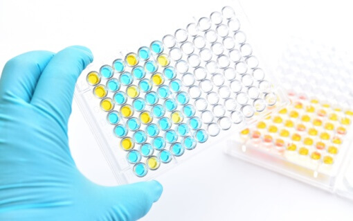 ELISA (Direct, Indirect, Competitive) ELISA (Direct, Indirect, Competitive)